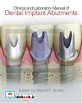 Clinical and Laboratory Manual of Dental Implant Abutments