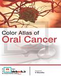 Color Atlas of Oral Cancer