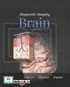 Diagnostic Imaging: Brain