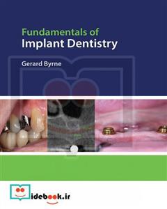 قیمت و خرید Fundamentals of Implant Dentistry