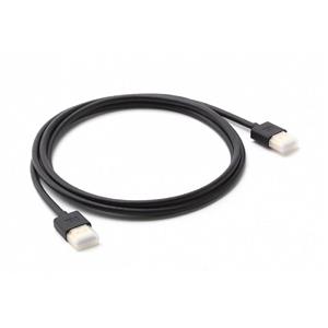 کابل HDMI شیاومی به طول 1.5 متر Xiaomi HDMI Cable 1.5m