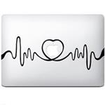 Wensoni iPulse MacBook Sticker