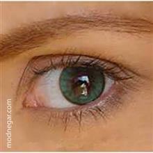 لنز طبی سولوتیکا با دور verde لنزطبی سولوتیکا رنگ ورده